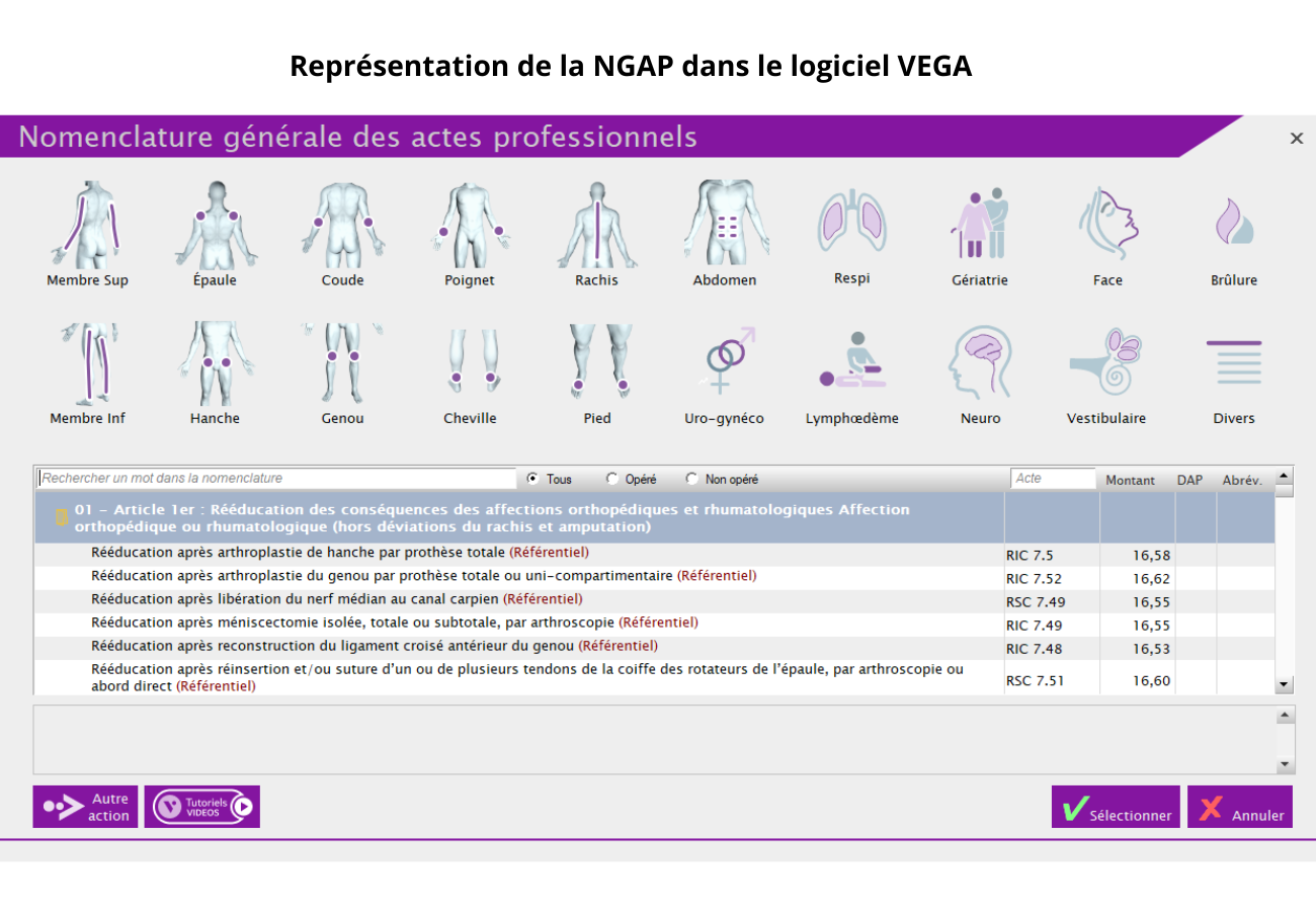 Visuel-NGAP-VEGA-Representation-de-la-NGAP-dans-le-logiciel-VEGA
